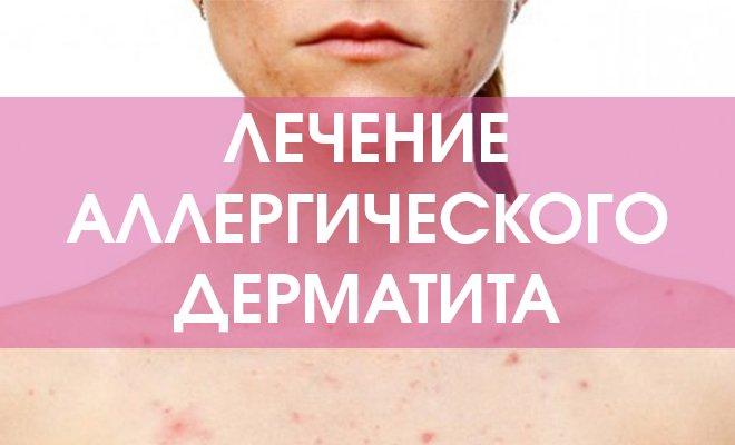 metody-lecheniya-allergicheskogo-dermatita
