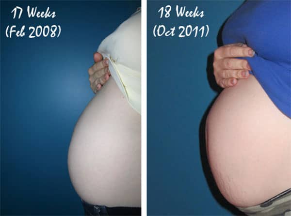 фото животиков на 18 неделе беременности фото 1