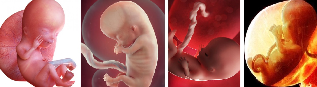 Как выглядит плод 10 11 недель беременности фото