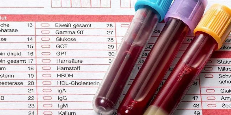 Биохимия крови